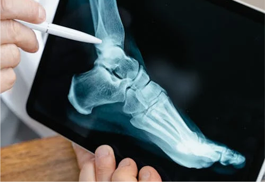 Imagem do Exame Densitometria Óssea